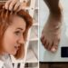 Hair loss: Three dietary causes of hair loss – and how to remedy them