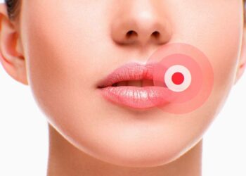 Best Herpes Supplements – Top Natural Support Products to Buy