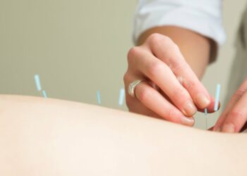 why-acupuncture-is-going-mainstream-in-medicine