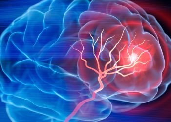 how-people-with-diabetes-can-lower-stroke-risk