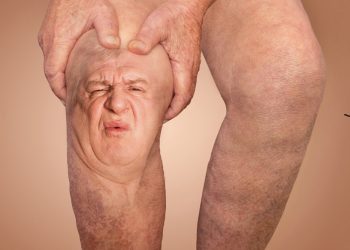 relieve-arthritis-pain-naturally