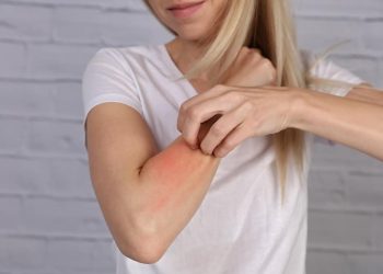 how-to-prevent-eczema-flare-ups:-9-tips-for-healthier,-more-comfortable-skin