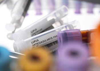 the-most-exciting-new-advancements-in-managing-and-treating-lupus