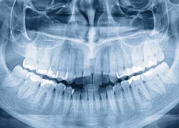 who-knew-humans-have-a-third-set-of-teeth?