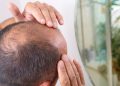 6-best-fixes-for-fighting-hair-loss-and-winning
