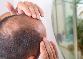 6-best-fixes-for-fighting-hair-loss-and-winning