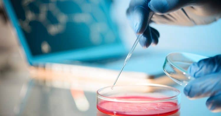 first-us.-case-of-sexually-transmitted-fungal-infection-found-in-new-york-city