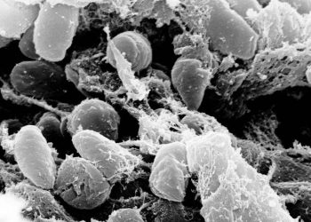 colorado-plague-case-is-a-reminder-that-the-‘black-death’-never-really-went-away