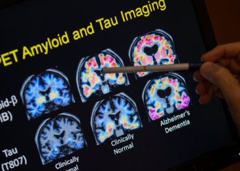 blood-tests-for-alzheimer’s-may-be-coming-to-your-doctor’s-office