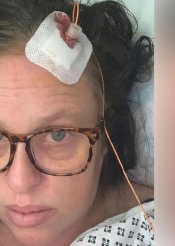 ‘I thought it was a miracle cure, but ended up blind in one eye and in brain surgery hell’