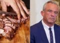 RFK Jr. Spouts Unproven Idea That Keto Diet Can ‘Cure’ Schizophrenia